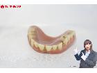 入れ歯 金歯 総重量:約21.9g まとめてセット 義歯 歯科用品の詳細ページを開く