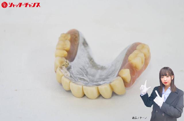 入れ歯 総重量:約39.1g 金パラ 銀パラ 義歯 歯科技工