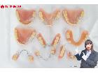入れ歯 まとめてセット 総重量:約121.7g パラジウム 銀 義歯 歯科金属 歯科材料 歯科技工の詳細ページを開く